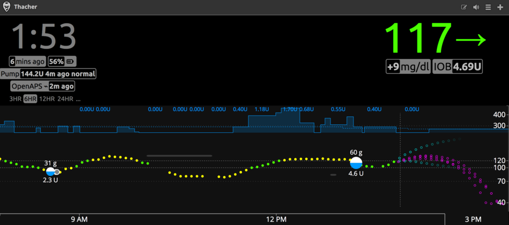 OpenAPS NightScout Dashboard