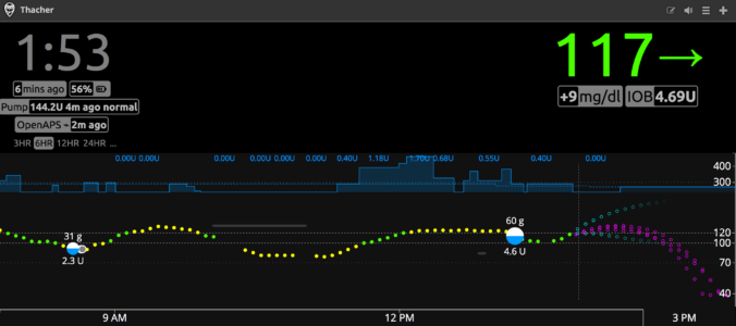 OpenAPS NightScout Dashboard